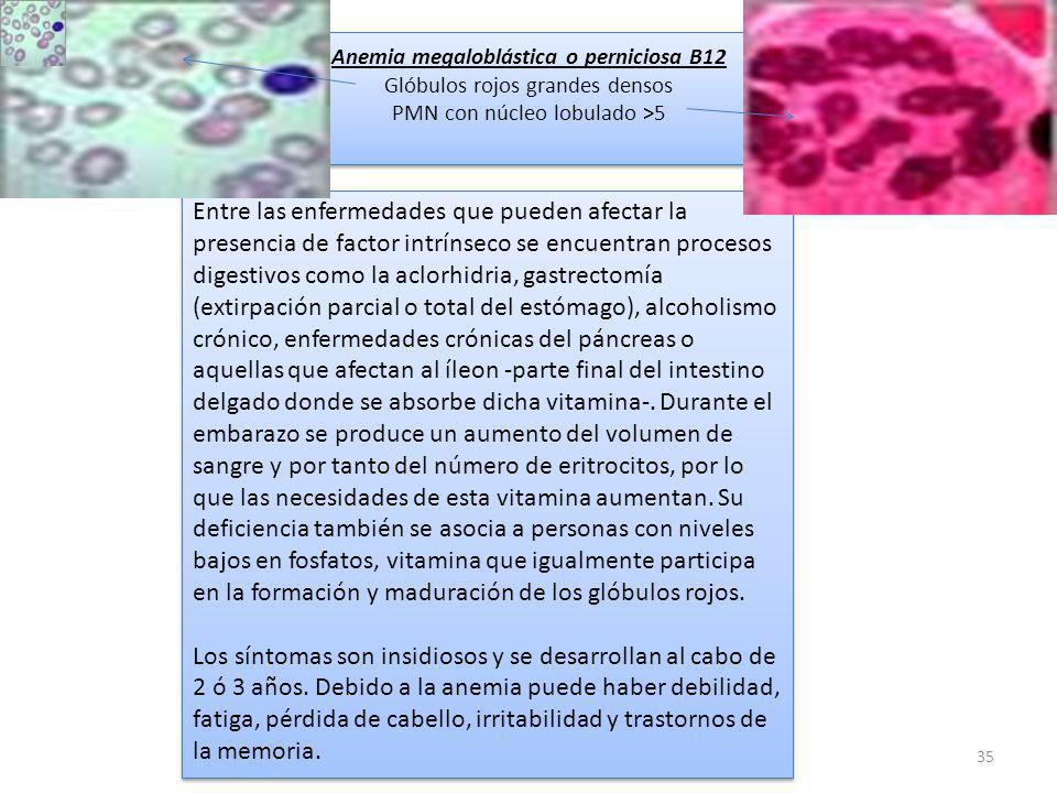 Anemia megaloblástica o perniciosa B12 Glóbulos rojos grandes densos PMN con núcleo lobulado >5