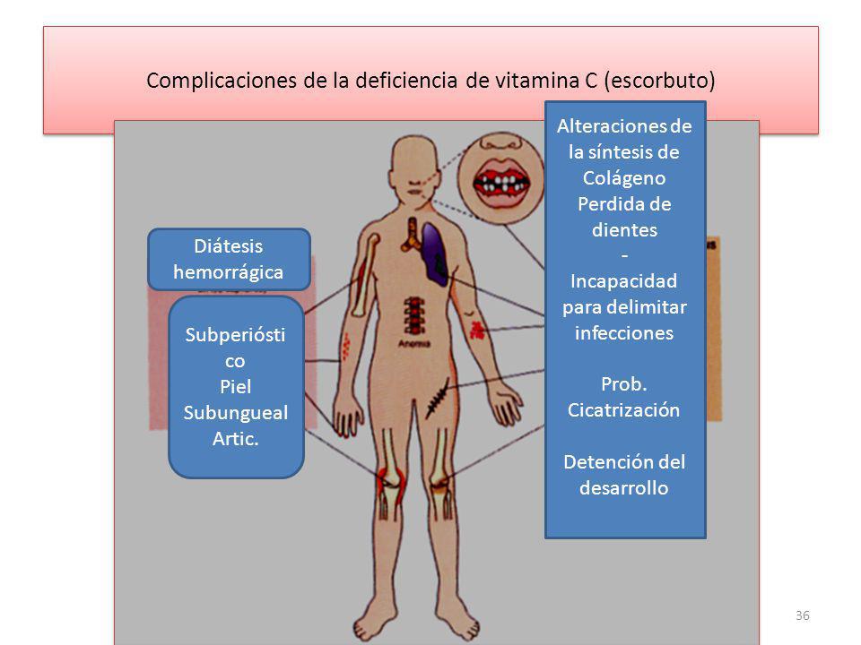 Complicaciones de la deficiencia de vitamina C (escorbuto)