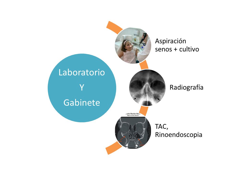 Laboratorio Y Gabinete Aspiración senos + cultivo Radiografía