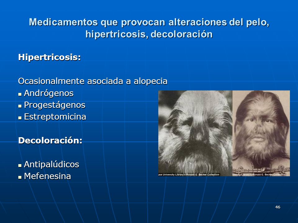 Medicamentos que provocan alteraciones del pelo, hipertricosis, decoloración