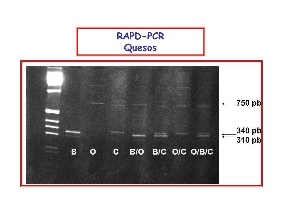 RAPD-PCR Quesos 750 pb 340 pb 310 pb B O C B/O B/C O/C O/B/C