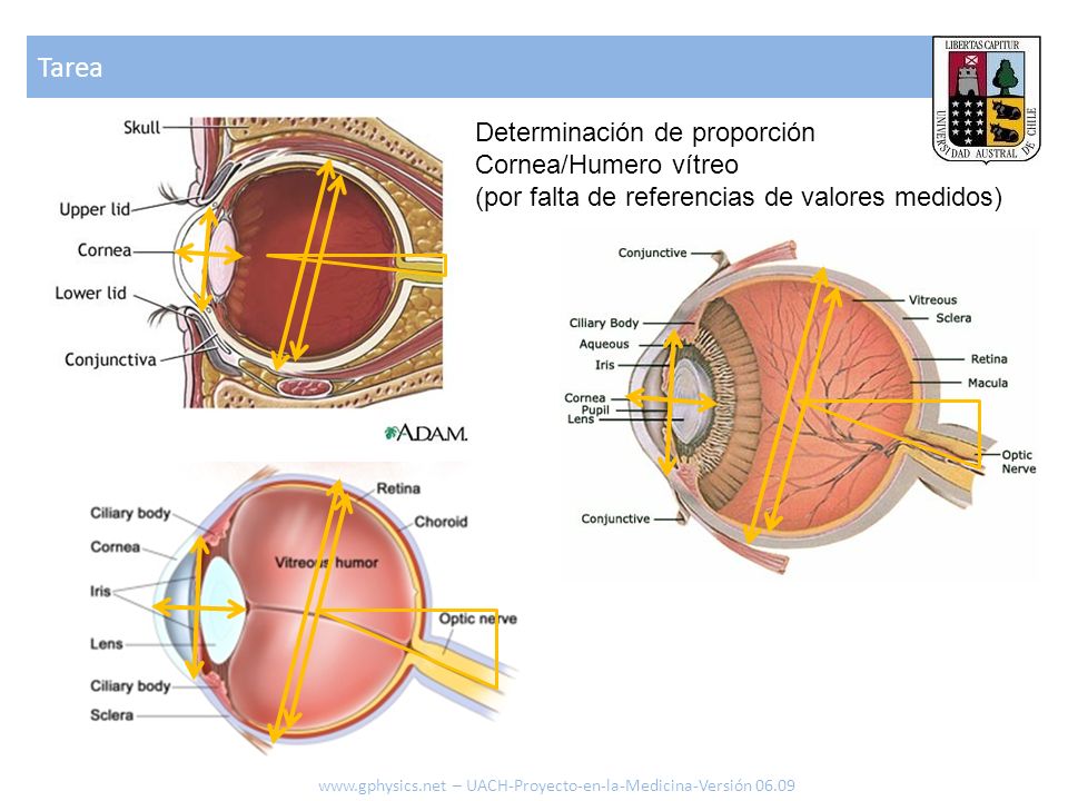 Tarea Determinación de proporción Cornea/Humero vítreo