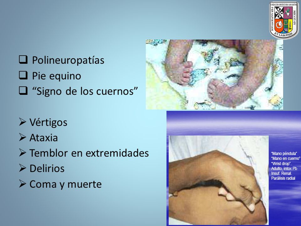 Polineuropatías Pie equino. Signo de los cuernos Vértigos. Ataxia. Temblor en extremidades. Delirios.
