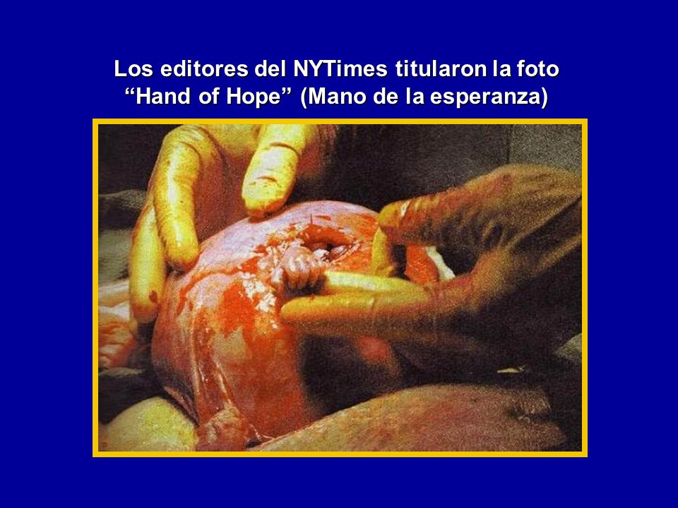 Los editores del NYTimes titularon la foto Hand of Hope (Mano de la esperanza)