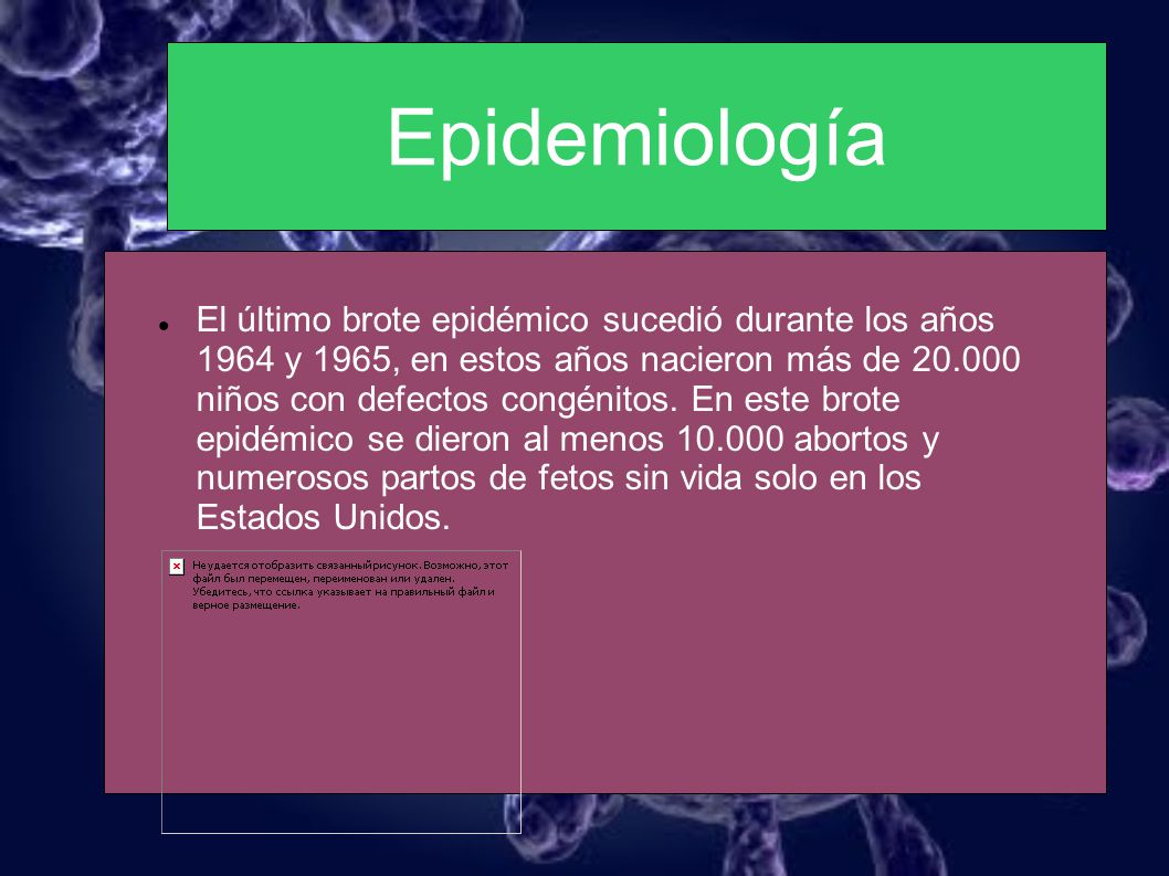 Epidemiología