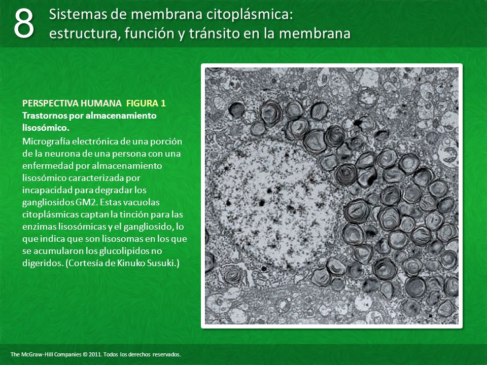 PERSPECTIVA HUMANA FIGURA 1 Trastornos por almacenamiento lisosómico.