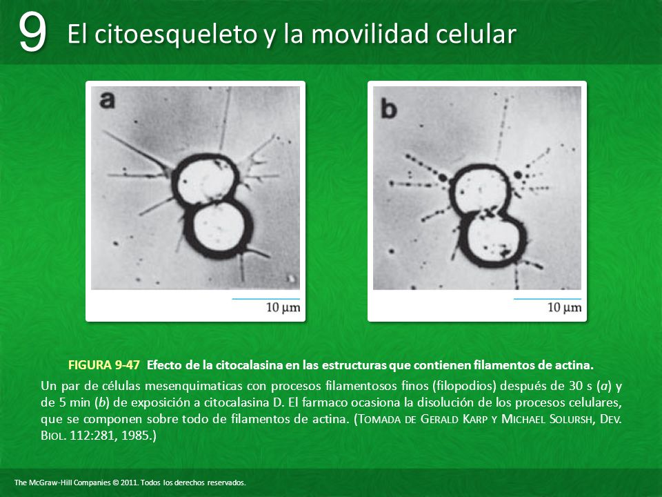 FIGURA 9-47 Efecto de la citocalasina en las estructuras que contienen filamentos de actina.