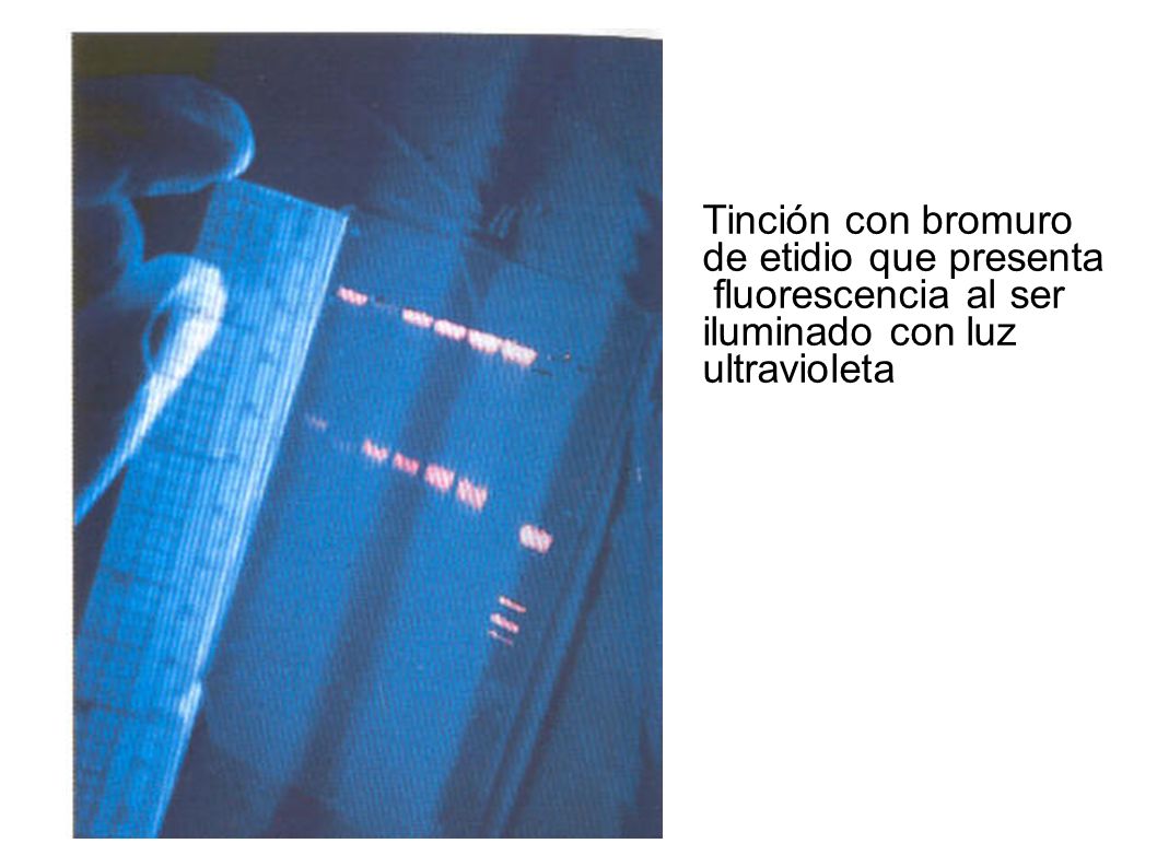 Tinción con bromuro de etidio que presenta fluorescencia al ser iluminado con luz ultravioleta