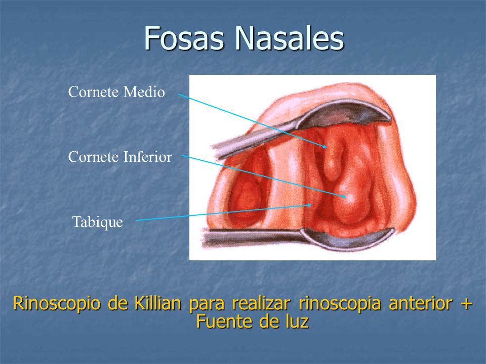 Fosas Nasales Cornete Medio. Cornete Inferior. Tabique.