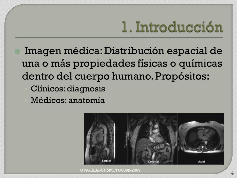 1. Introducción Imagen médica: Distribución espacial de una o más propiedades físicas o químicas dentro del cuerpo humano. Propósitos: