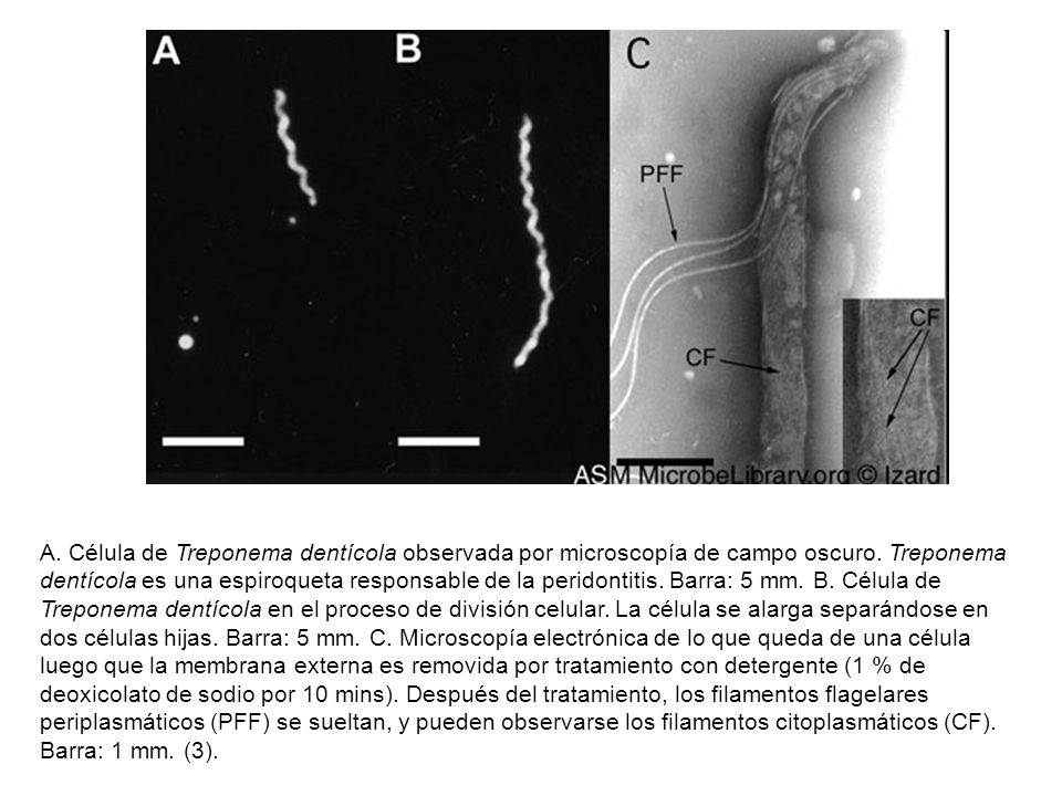 A. Célula de Treponema dentícola observada por microscopía de campo oscuro.