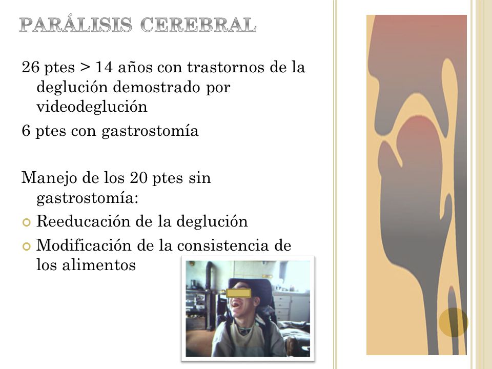26 ptes > 14 años con trastornos de la deglución demostrado por videodeglución