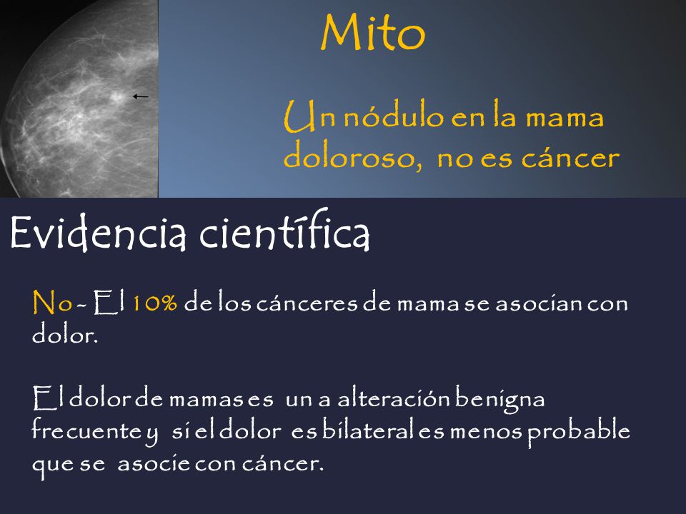 Mito Evidencia científica Un nódulo en la mama doloroso, no es cáncer