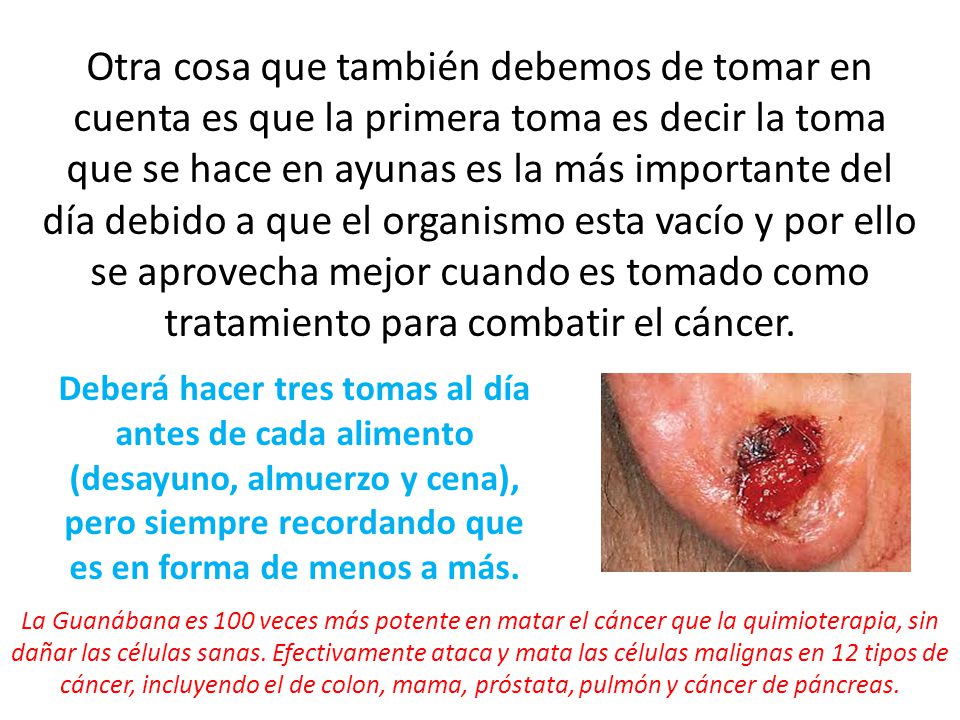 Otra cosa que también debemos de tomar en cuenta es que la primera toma es decir la toma que se hace en ayunas es la más importante del día debido a que el organismo esta vacío y por ello se aprovecha mejor cuando es tomado como tratamiento para combatir el cáncer.