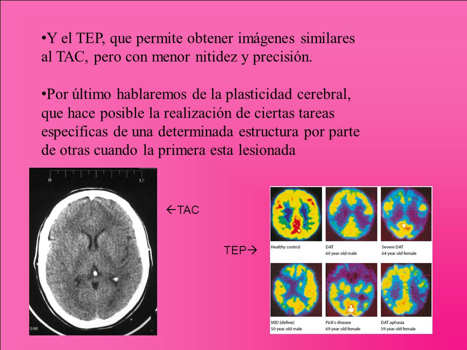 Y el TEP, que permite obtener imágenes similares al TAC, pero con menor nitidez y precisión.