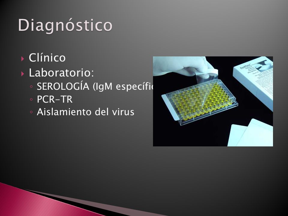 Diagnóstico Clínico Laboratorio: SEROLOGÍA (IgM específica) PCR-TR