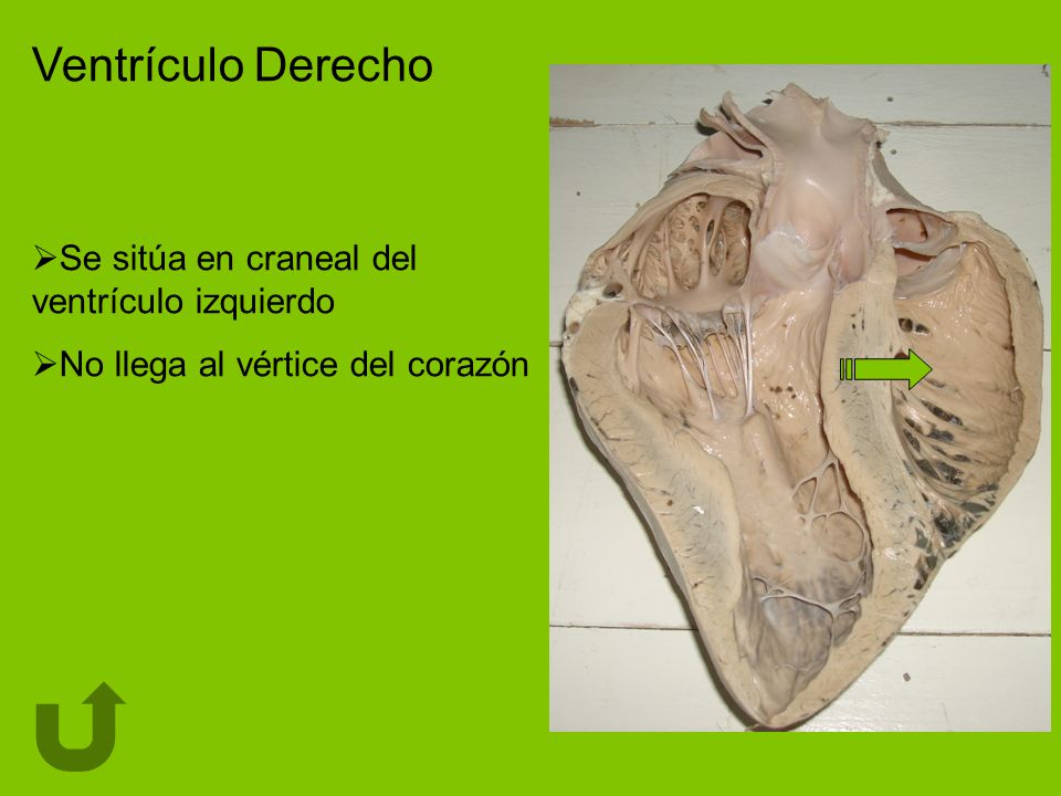 Ventrículo Derecho Se sitúa en craneal del ventrículo izquierdo