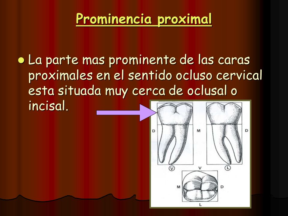 Prominencia proximal La parte mas prominente de las caras proximales en el sentido ocluso cervical esta situada muy cerca de oclusal o incisal.