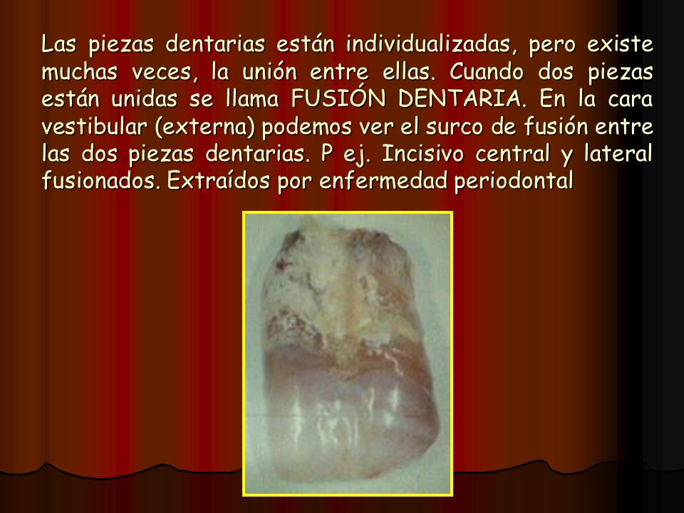 Las piezas dentarias están individualizadas, pero existe muchas veces, la unión entre ellas.
