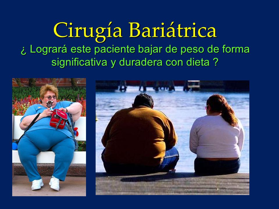 Cirugía Bariátrica ¿ Logrará este paciente bajar de peso de forma significativa y duradera con dieta