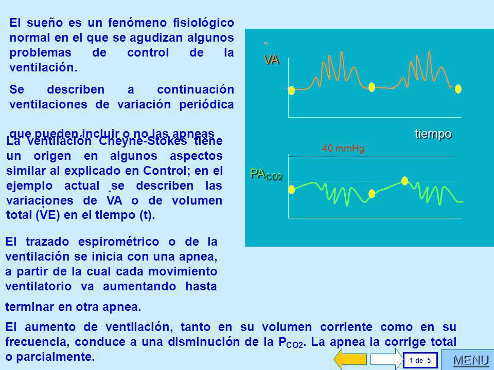 El sueño es un fenómeno fisiológico normal en el que se agudizan algunos problemas de control de la ventilación.