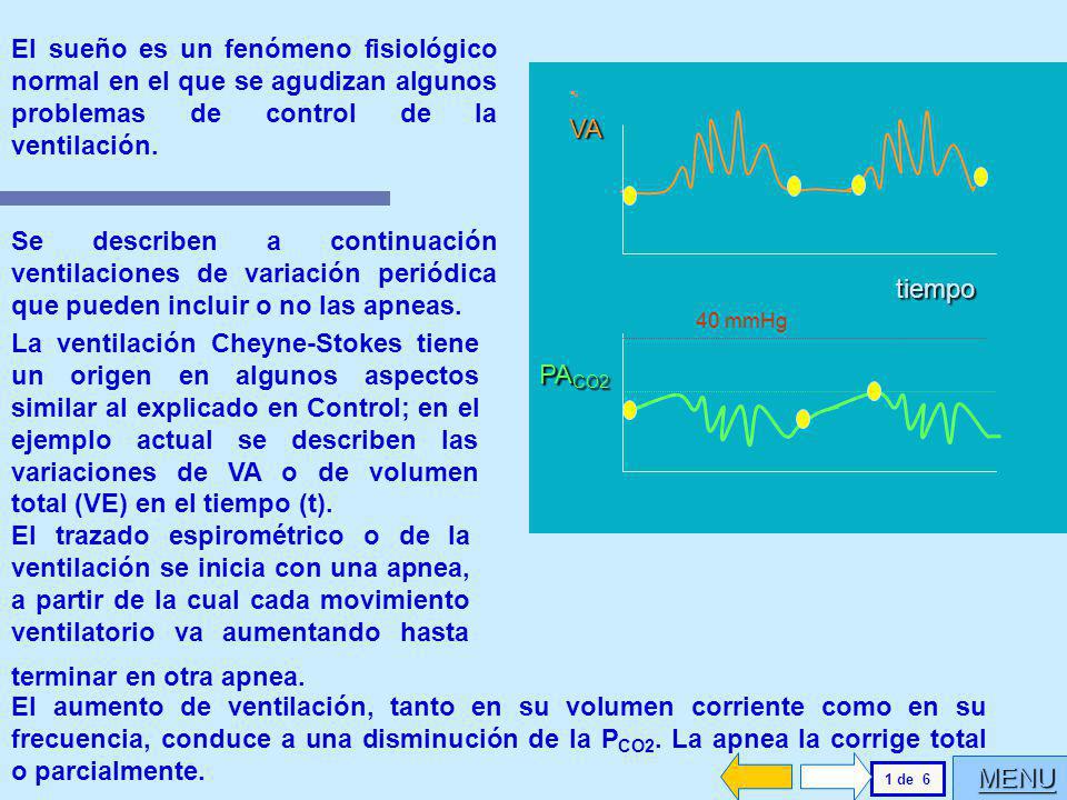 El sueño es un fenómeno fisiológico normal en el que se agudizan algunos problemas de control de la ventilación.
