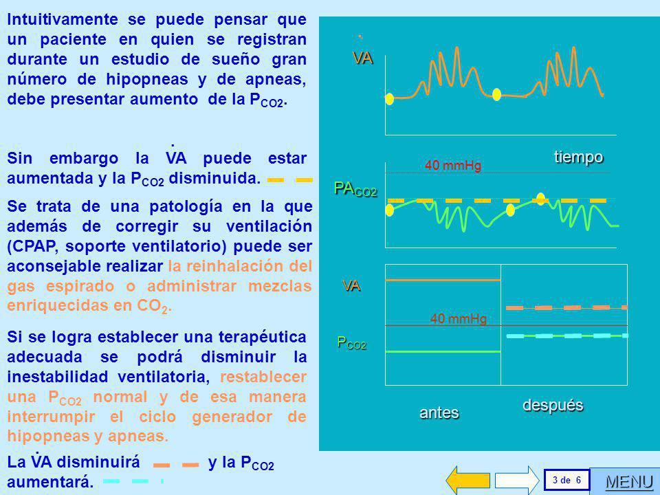 Sin embargo la VA puede estar aumentada y la PCO2 disminuida.