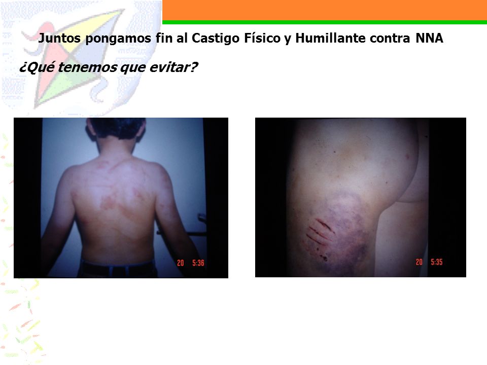 Juntos pongamos fin al Castigo Físico y Humillante contra NNA