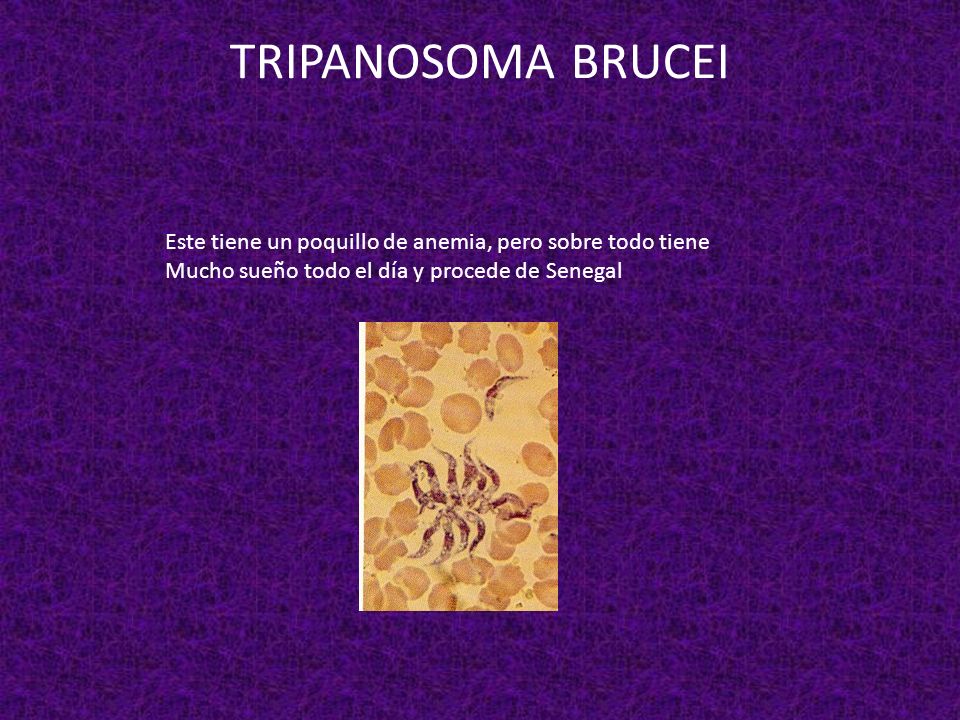 TRIPANOSOMA BRUCEI Este tiene un poquillo de anemia, pero sobre todo tiene.