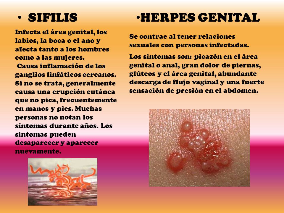 SIFILIS HERPES GENITAL