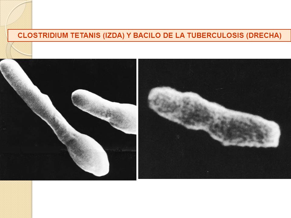 CLOSTRIDIUM TETANIS (IZDA) Y BACILO DE LA TUBERCULOSIS (DRECHA)