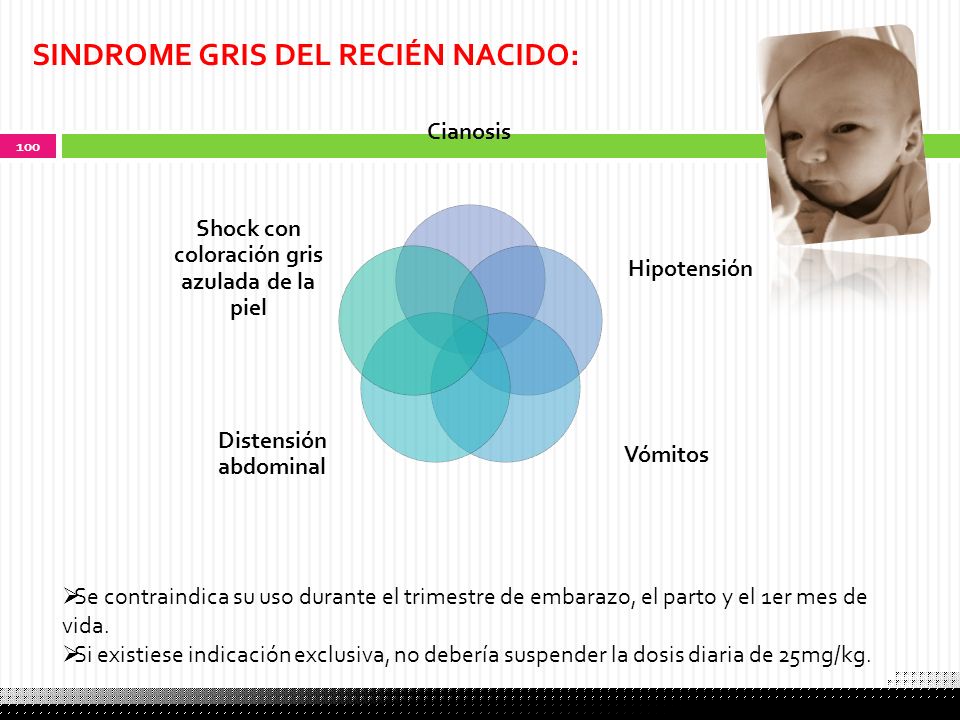 Shock con coloración gris azulada de la piel
