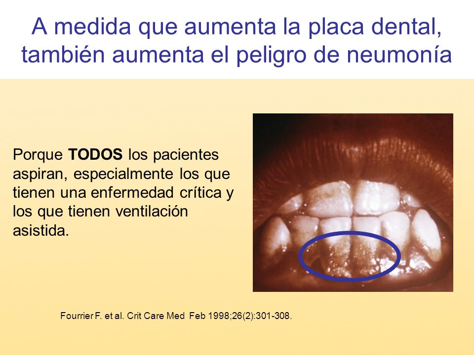 A medida que aumenta la placa dental, también aumenta el peligro de neumonía