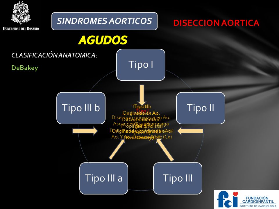 AGUDOS Tipo I Tipo II Tipo III Tipo III a Tipo III b