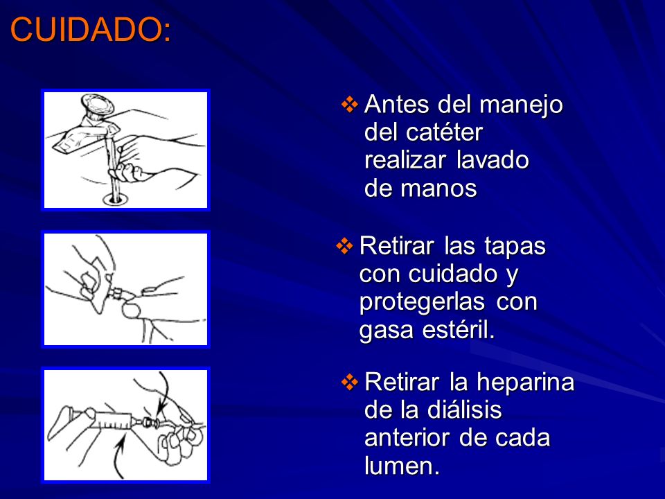 CUIDADO: Antes del manejo del catéter realizar lavado de manos