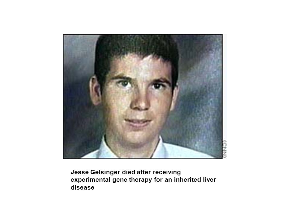 Jesse Gelsinger died after receiving experimental gene therapy for an inherited liver disease