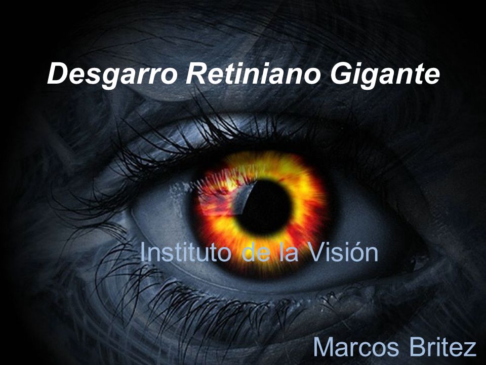 Desgarro Retiniano Gigante