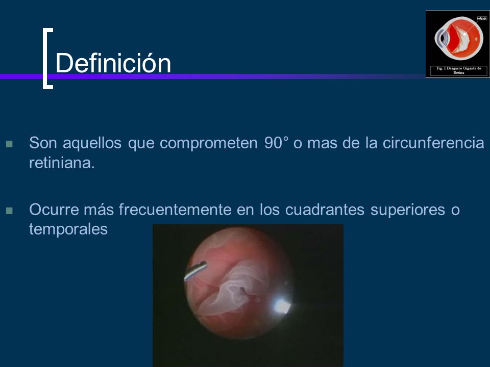 Definición Son aquellos que comprometen 90° o mas de la circunferencia retiniana.