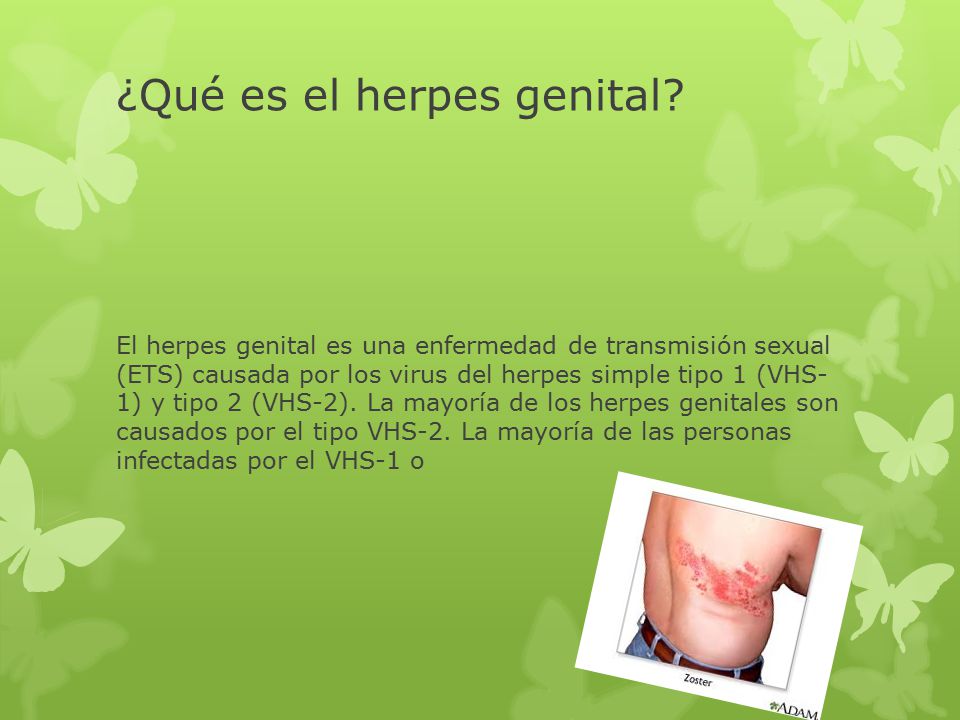 ¿Qué es el herpes genital