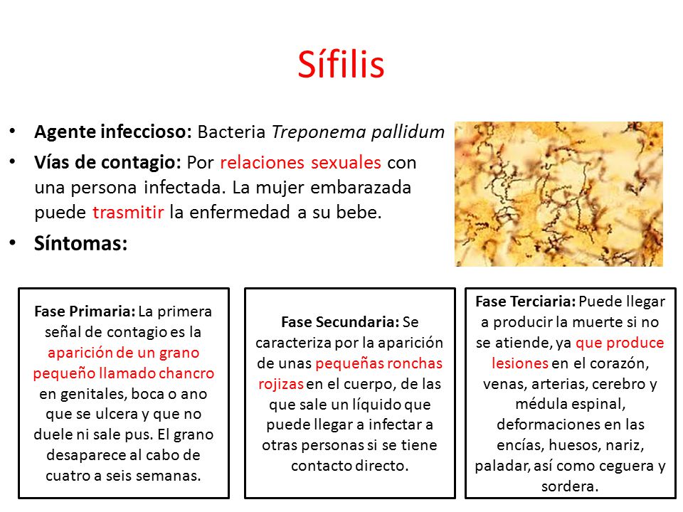 Sífilis Síntomas: Agente infeccioso: Bacteria Treponema pallidum