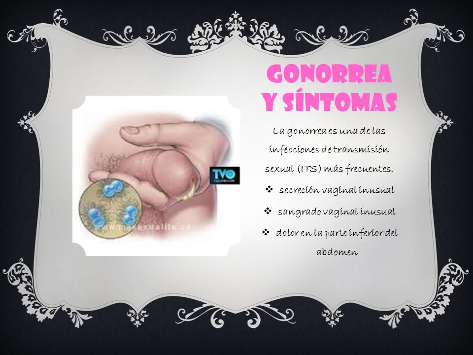 Gonorrea y síntomas La gonorrea es una de las infecciones de transmisión sexual (ITS) más frecuentes.