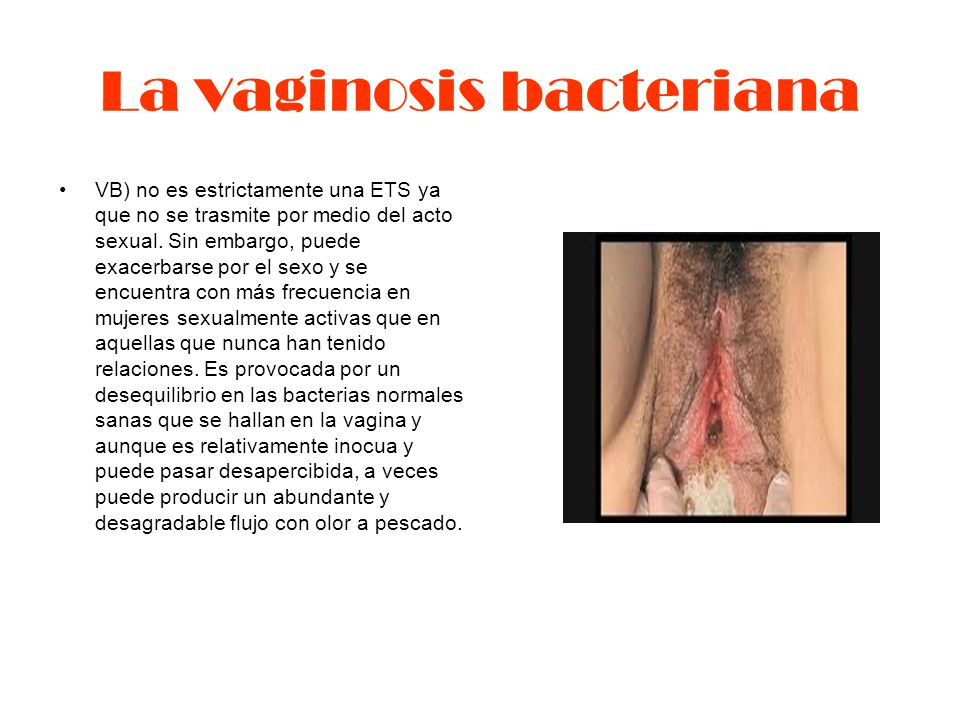 La vaginosis bacteriana