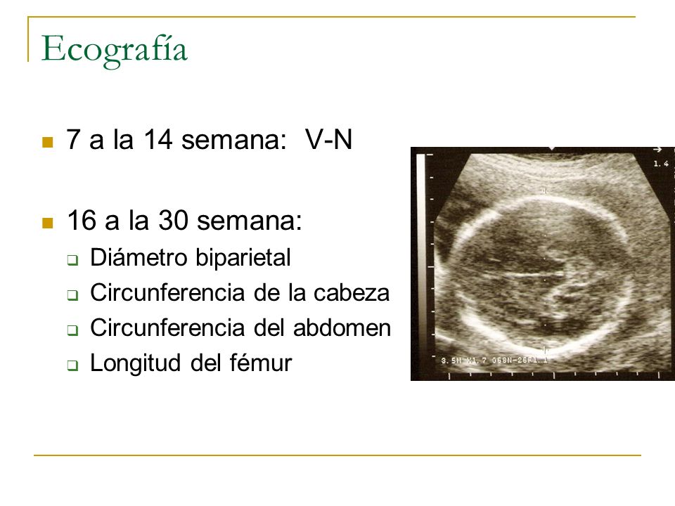Ecografía 7 a la 14 semana: V-N 16 a la 30 semana: Diámetro biparietal