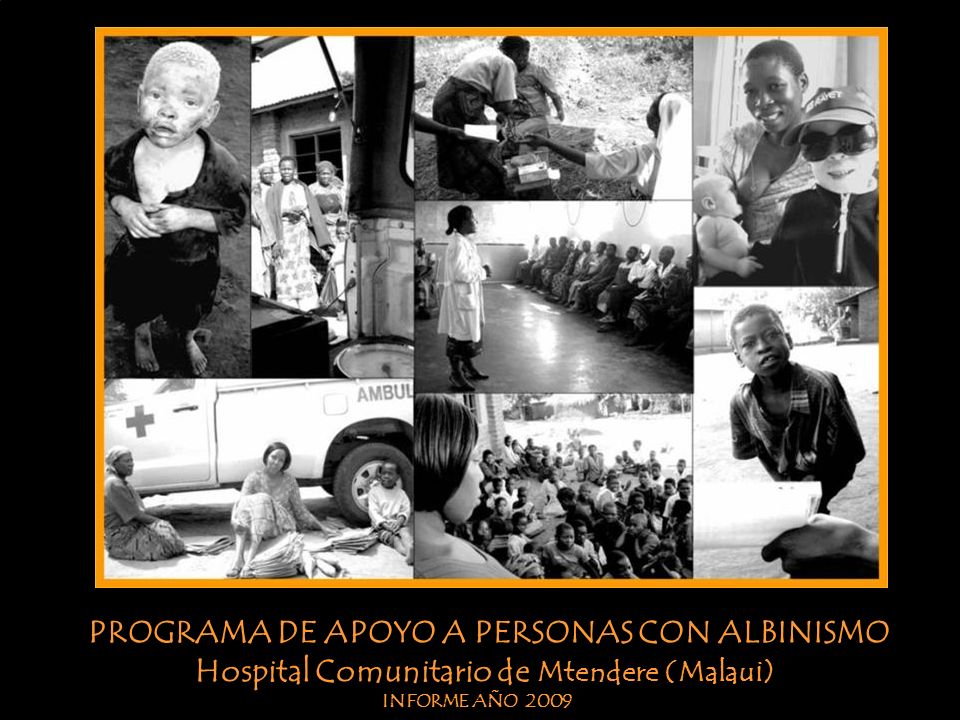 PROGRAMA DE APOYO A PERSONAS CON ALBINISMO Mtendere Community Hospital