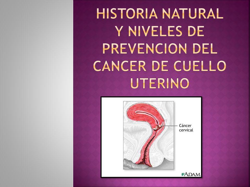 HISTORIA NATURAL Y NIVELES DE PREVENCION DEL CANCER DE CUELLO UTERINO