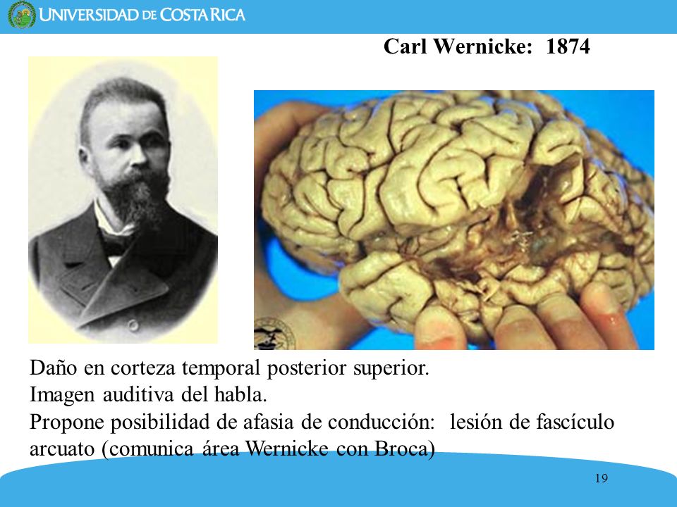 Carl Wernicke: 1874 Daño en corteza temporal posterior superior. Imagen auditiva del habla.