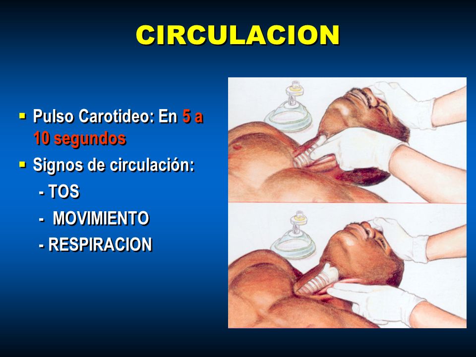 CIRCULACION Pulso Carotideo: En 5 a 10 segundos Signos de circulación: