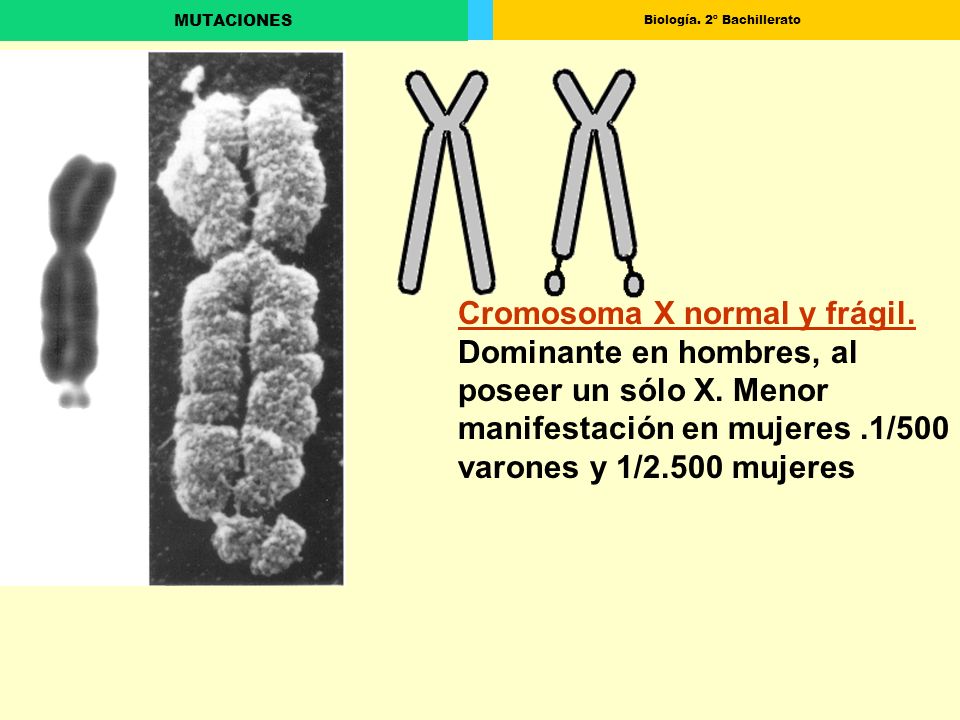 Cromosoma X normal y frágil. Dominante en hombres, al poseer un sólo X