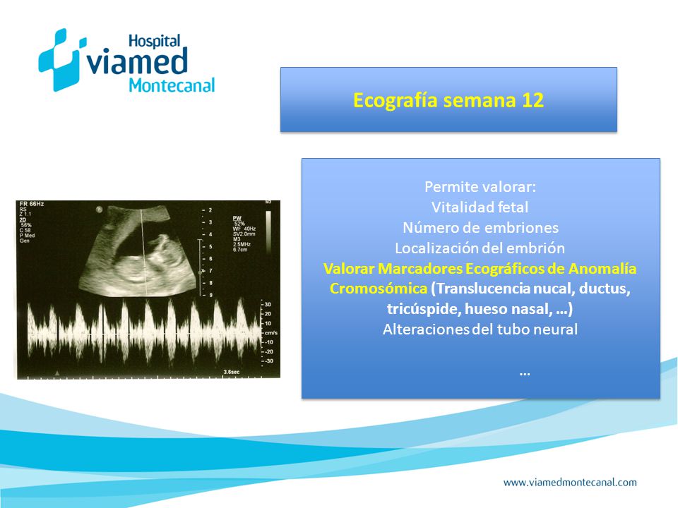 Ecografía semana 12 Permite valorar: Vitalidad fetal