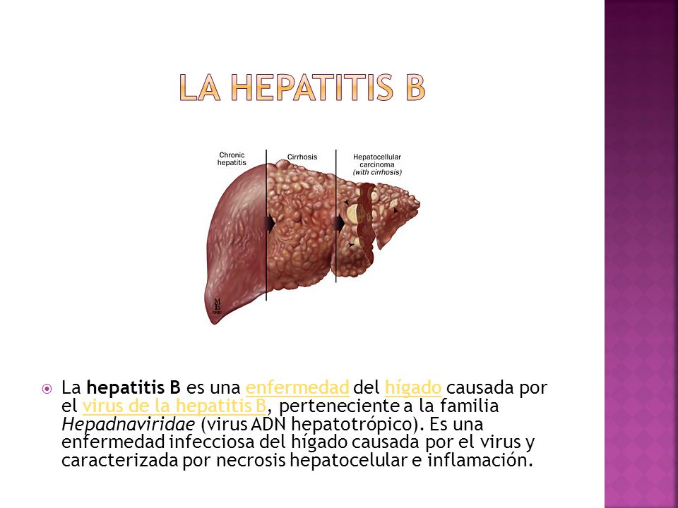 LA HEPATITIS B